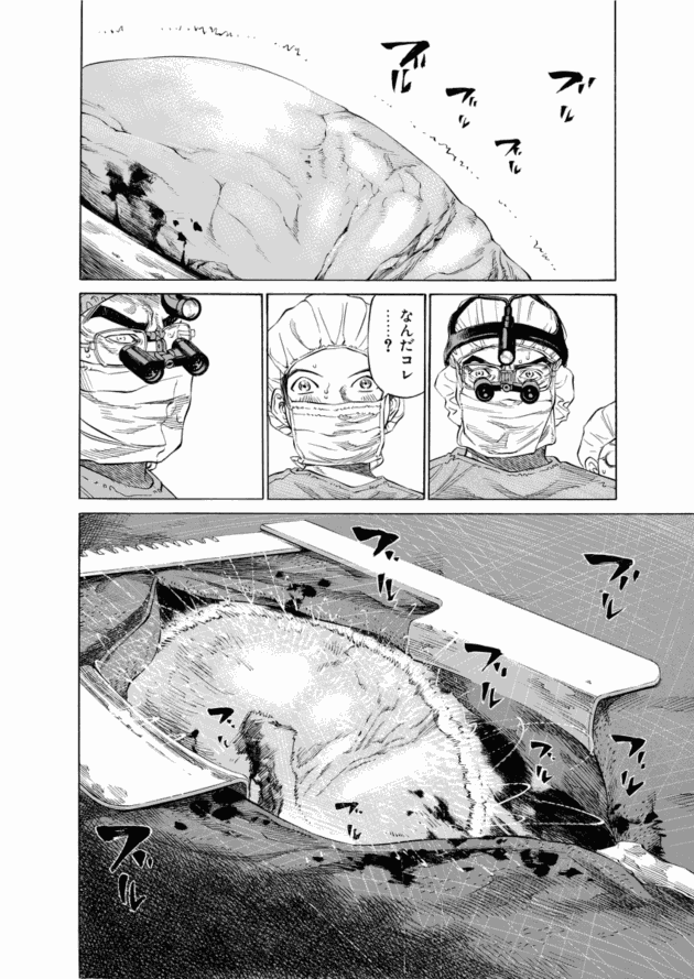 「ブラックジャックによろしく(2)／佐藤秀峰(著)」作品を二次利用しています。